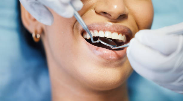 Best Emergency Dental Care for Broken or Chipped Teeth in Castlewood, VA