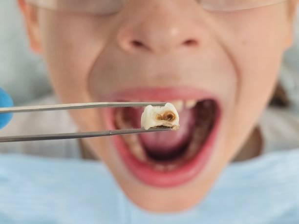Best Same-Day Emergency Dental Services in Castlewood, VA
