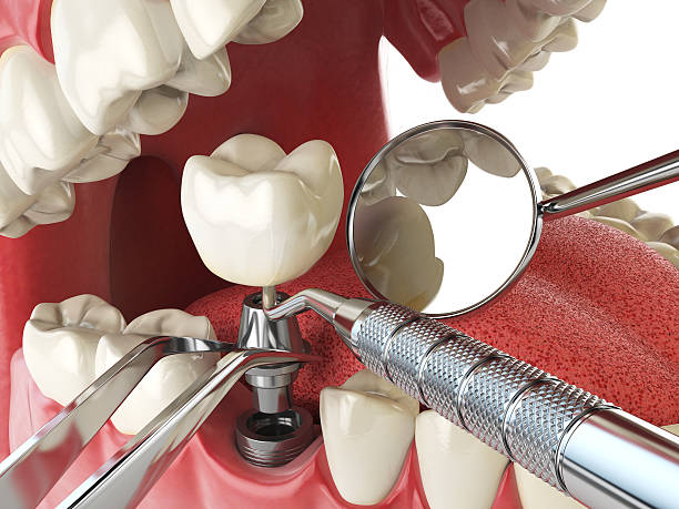 Best Emergency Denture Repair in Castlewood, VA